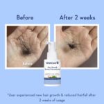 WishCare Hair Growth Serum Concentrate - Rosemary, 3% Redensyl, 4% Anagain, 2% Baicapil, Caffeine, Biotin, Plant Keratin & Rice Water - Image 4