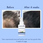 WishCare Hair Growth Serum Concentrate - Rosemary, 3% Redensyl, 4% Anagain, 2% Baicapil, Caffeine, Biotin, Plant Keratin & Rice Water - Image 5