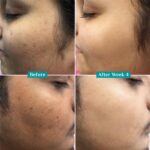 Pilgrim 10% Vitamin C Face Serum | Face Serum with 5% Niacinamide & Kakadu Plum | Lightweight Hydration, Smooth Texture, Non-Greasy Formula for Daily Skincare | 0.33 Fl Oz (10ml) - Image 6