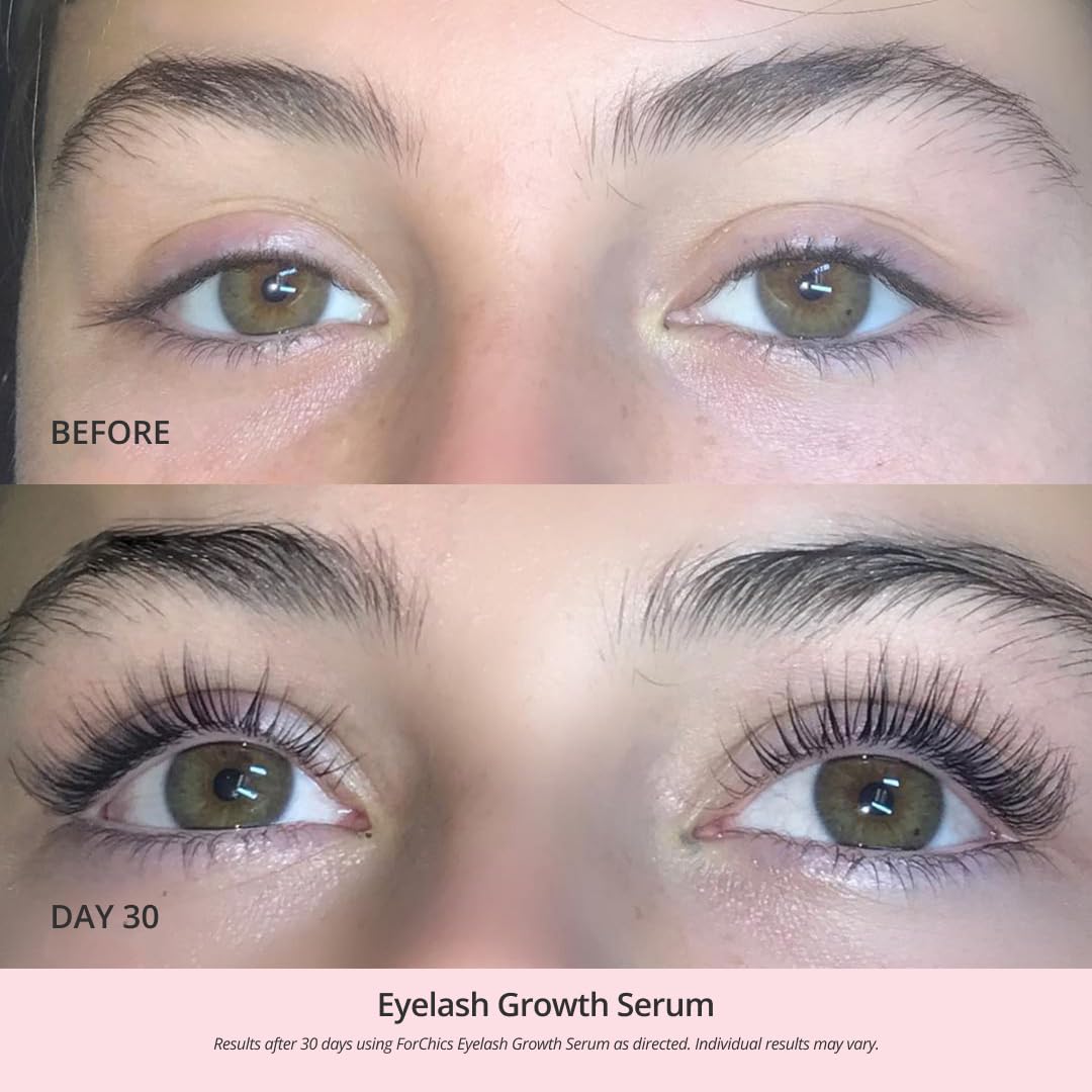 ForChics Eyelash Growth Serum - Prostaglandin-Free Lash Enhancing Serum for Longer, Thicker Lashes and Brows- Natural Formula, Visible Results in 2 Weeks - Vegan, Hormone-Free 0.10 fl. oz / 3ml - Image 5